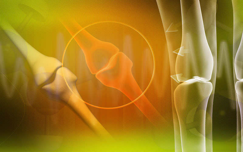 پوکی استخوان