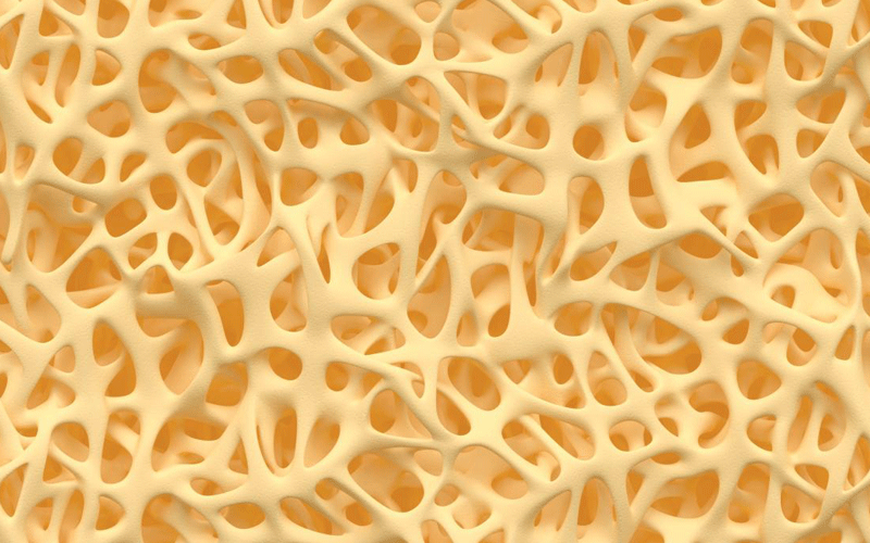 علل شیوع پوکی استخوان